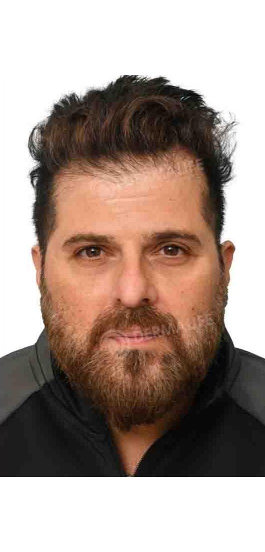 Bhakhtyar Irani — before hair transplant