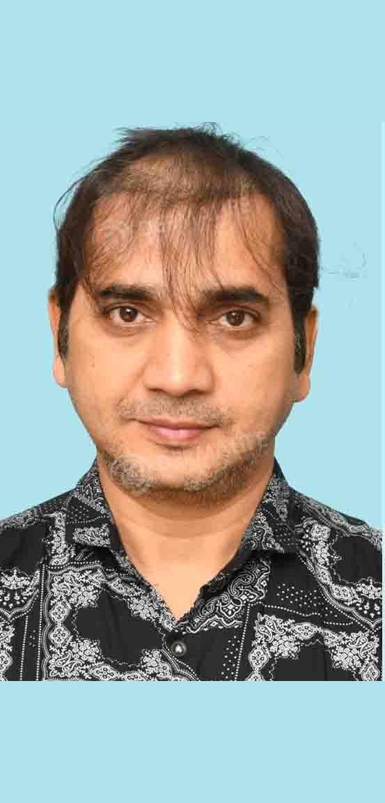 Saanand Verma — before hair transplant