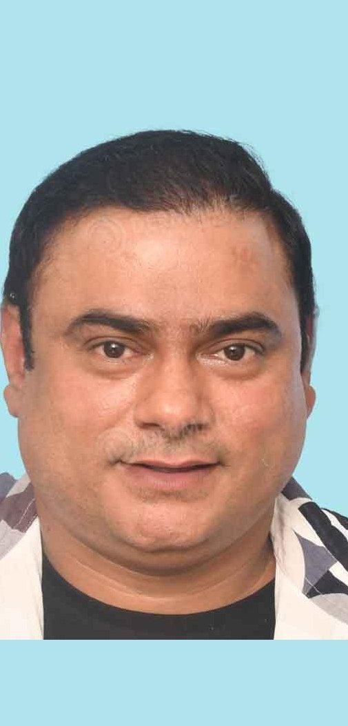 Saleem Zaidi — after hair transplant at Dermalife