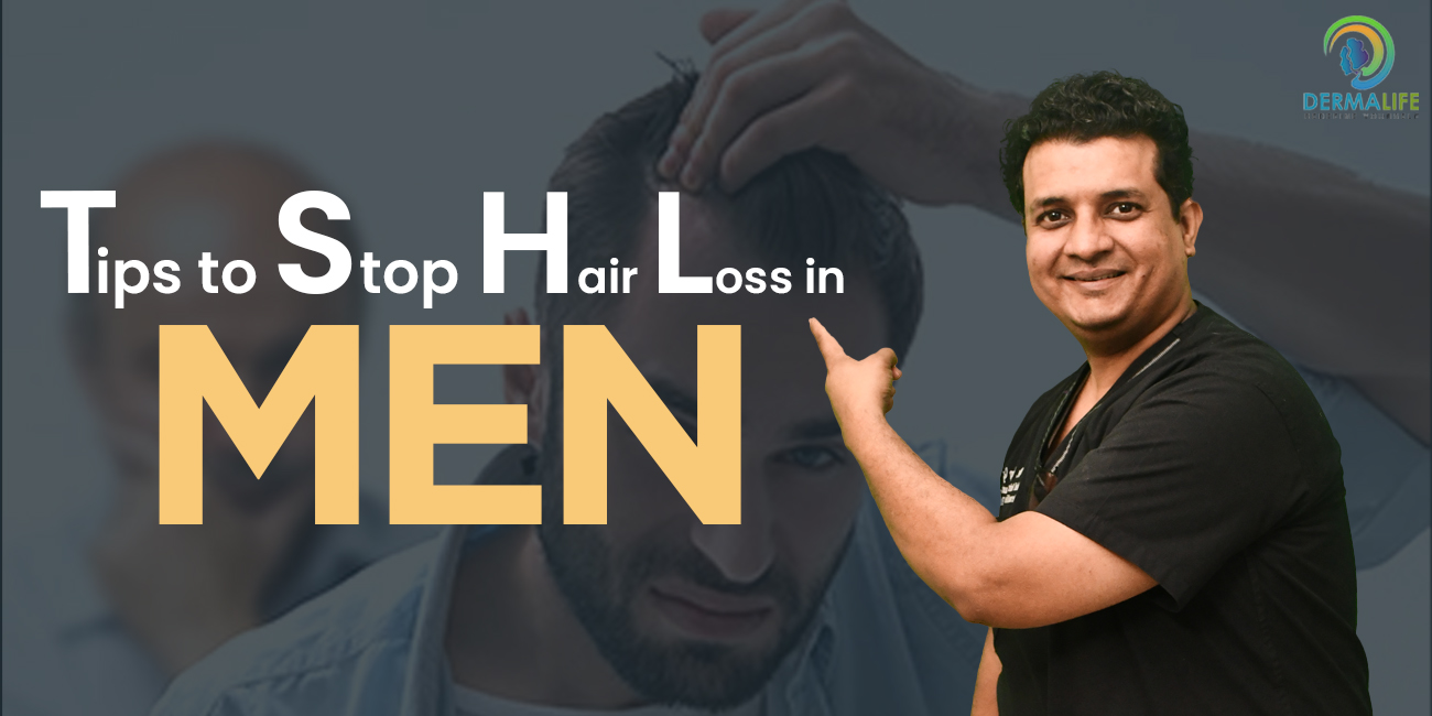 Tips to Stop Hair loss in Men