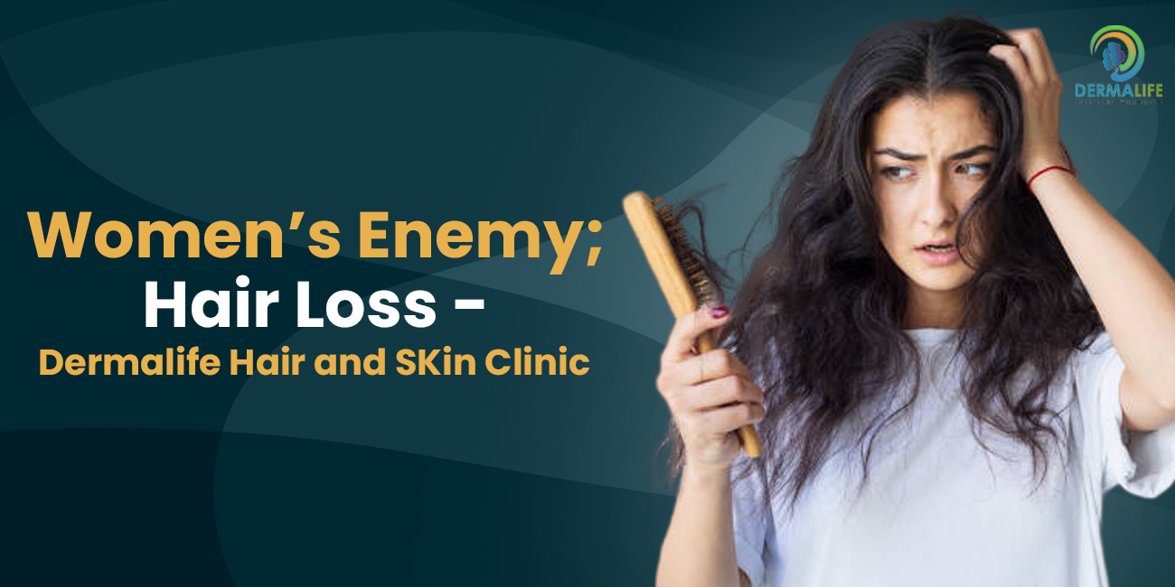 Women’s Enemy; Hair Loss
