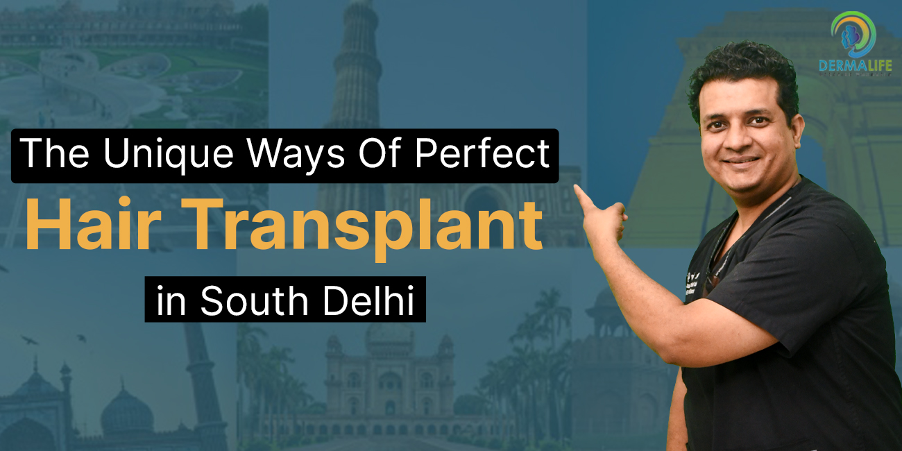 Unique Ways of Perfect Hair Transplant in South Delhi