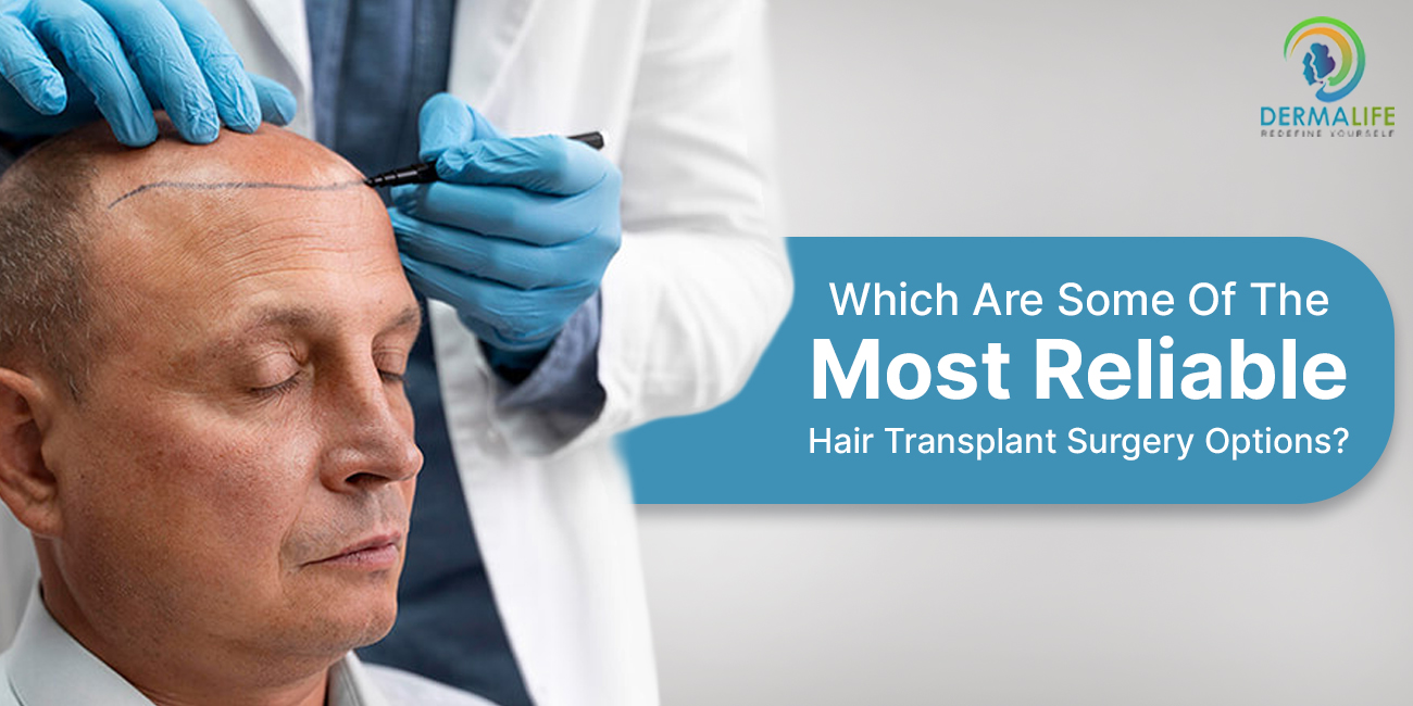 Which Are Some Of The Most Reliable Hair Transplant Surgery Options