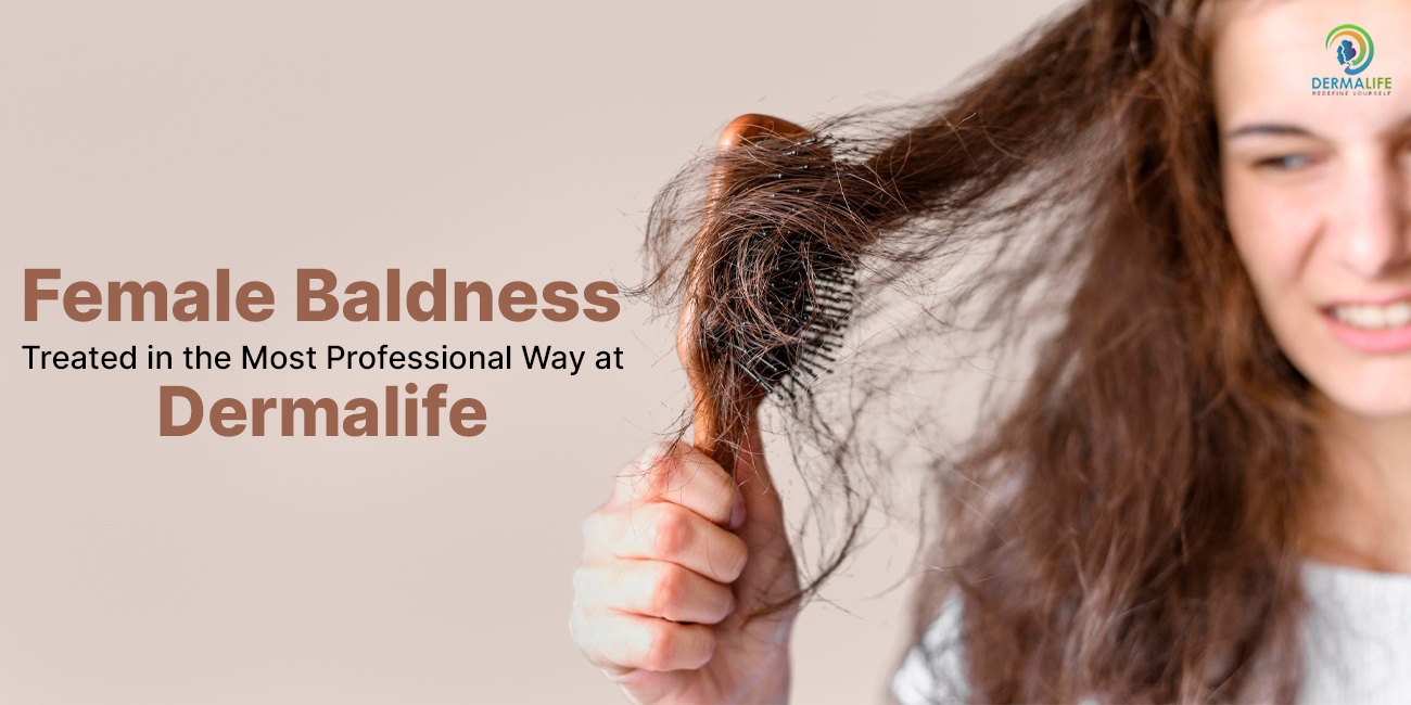 Female baldness treated in the most professional way at Dermalife