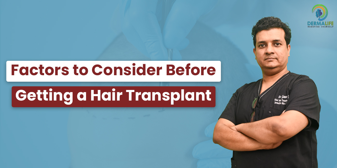 Factors to Consider Before Getting a Hair Transplant