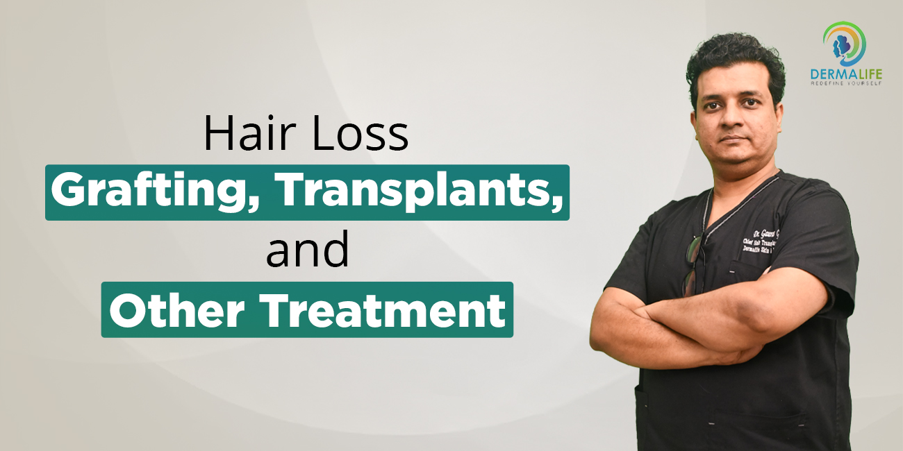Hair Loss Grafting, Transplants, and Other Treatment