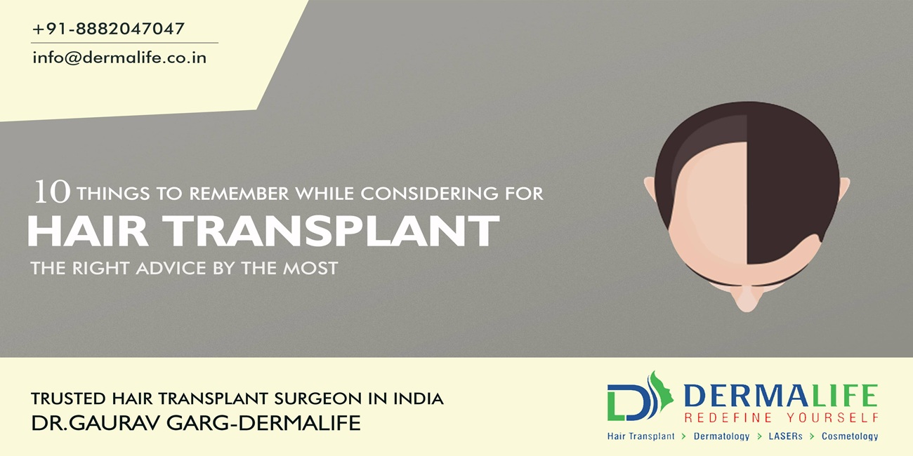 10 Things to Remember While Considering for Hair Transplant