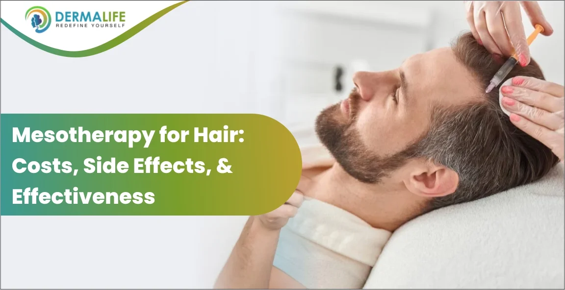 Mesotherapy for Hair