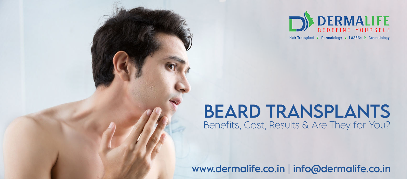Beard Transplant Cost and Benefits