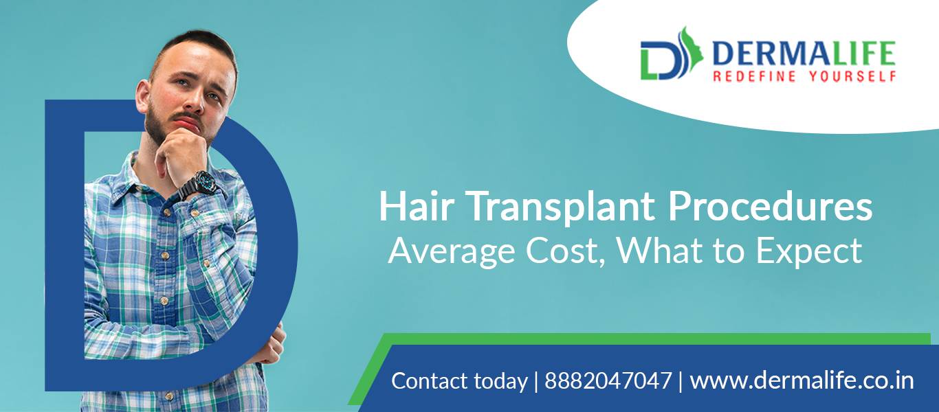What is Hair Transplant? | Hair Transplant Cost in India