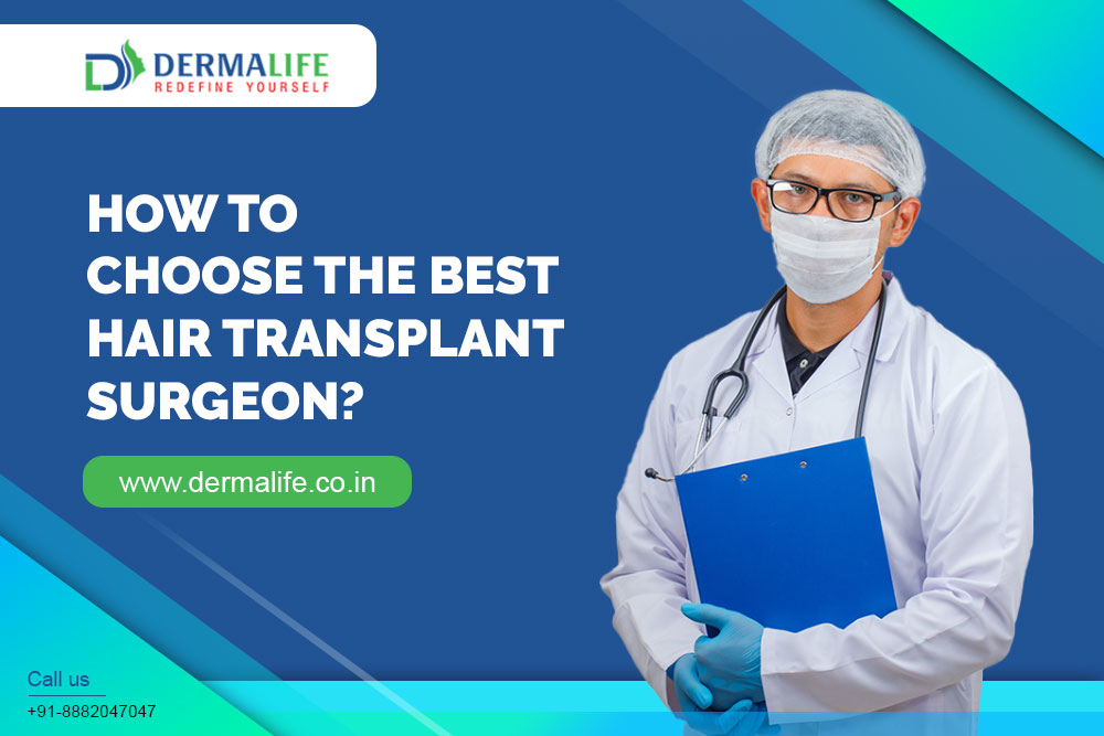 How to Choose Hair Transplant Surgeon | Best Hair Transplant Surgeon in  Delhi - Dermalife