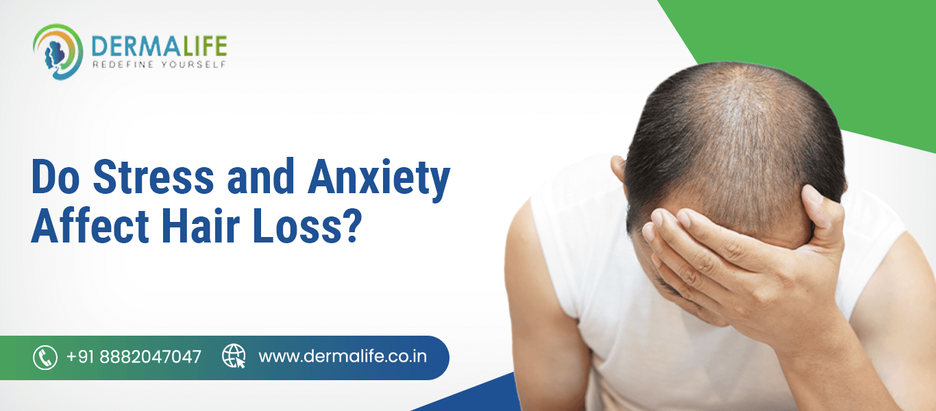 anxiety affect hair loss
