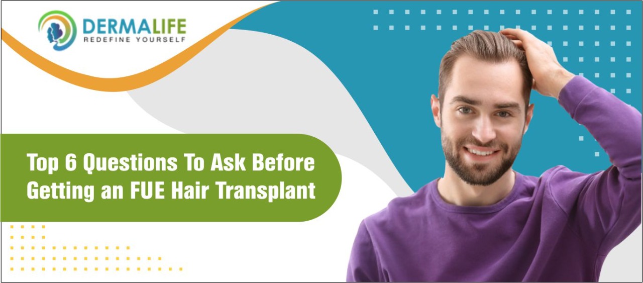 fue-hair-transplant
