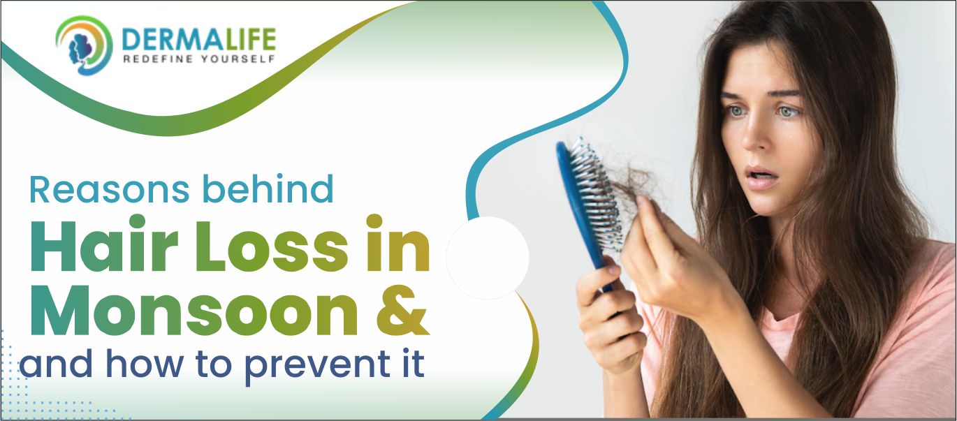 Reasons behind Hair Loss in Monsoon and how to prevent it | Dermalife Blog