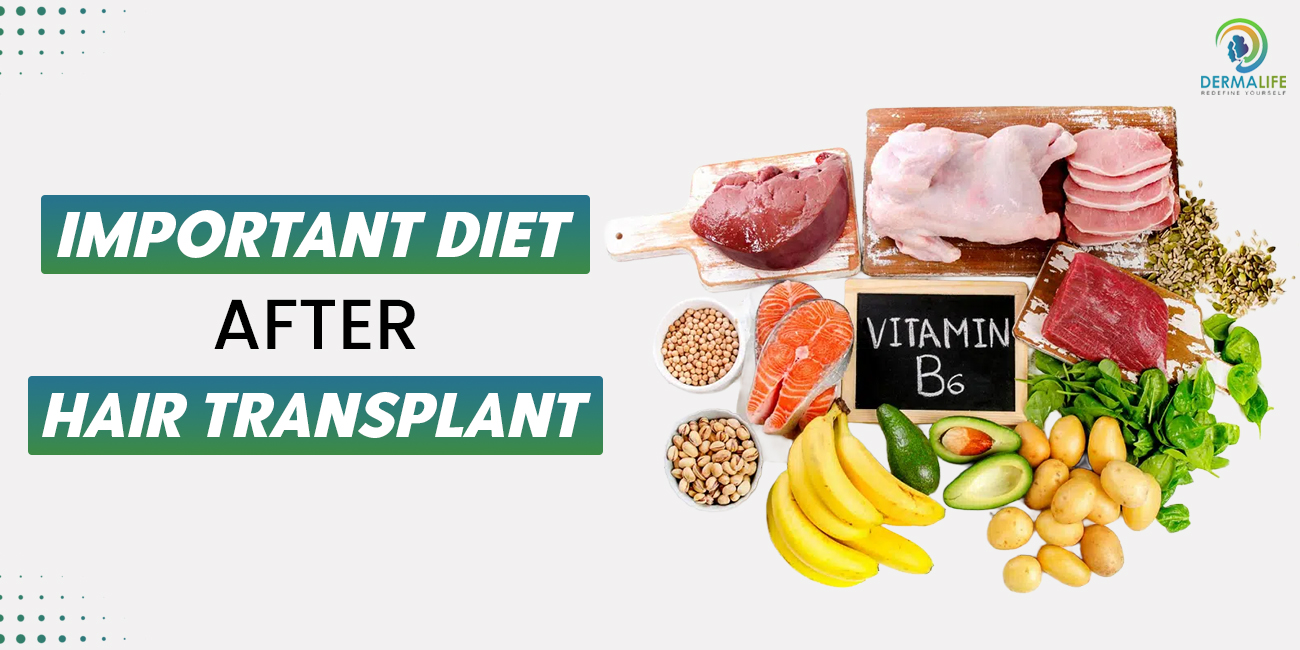 What To Eat After A Hair Transplant