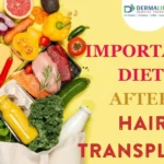 What To Eat After A Hair Transplant