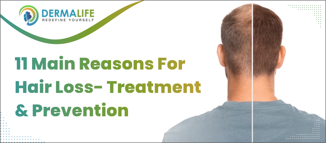 reasons for hair loss