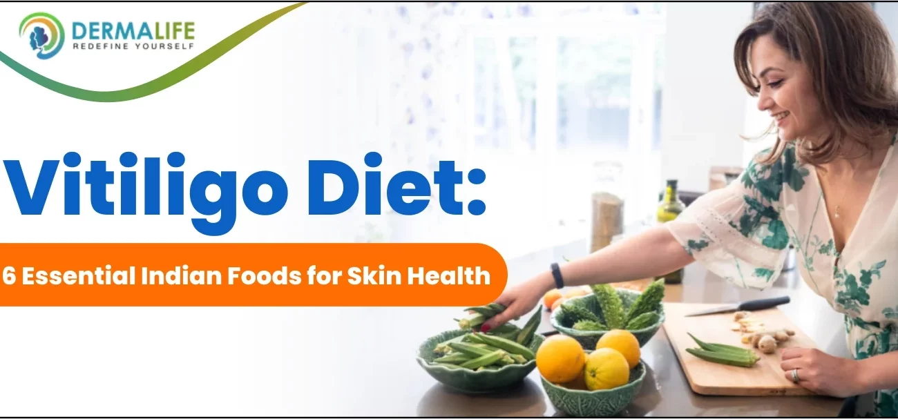 Vitiligo Diet: 6 Essential Indian Foods for Skin Health