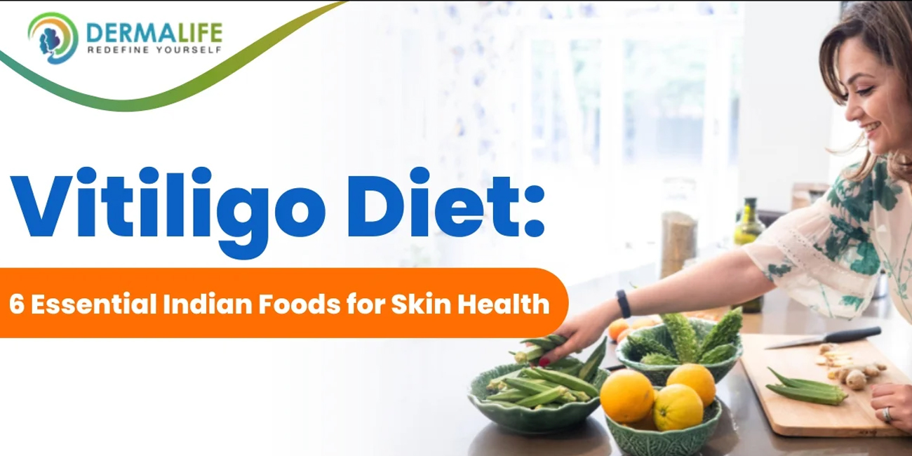 Vitiligo Diet 6 Essential Indian Foods for Skin Health