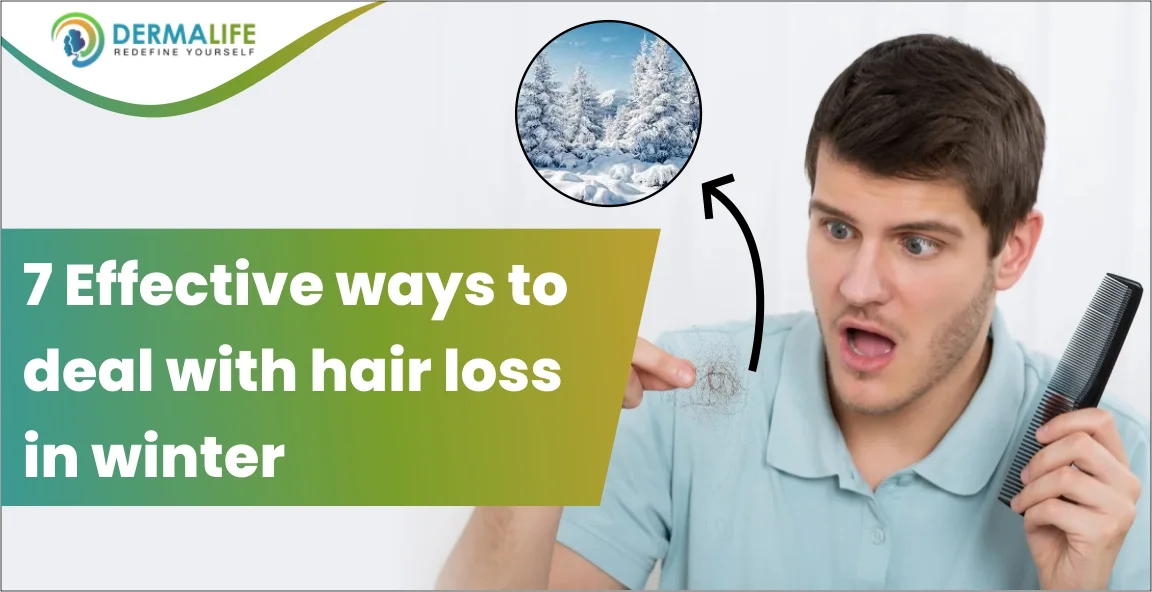 7 Effective ways to deal with hair loss in winter