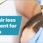 Best hair loss treatment for women