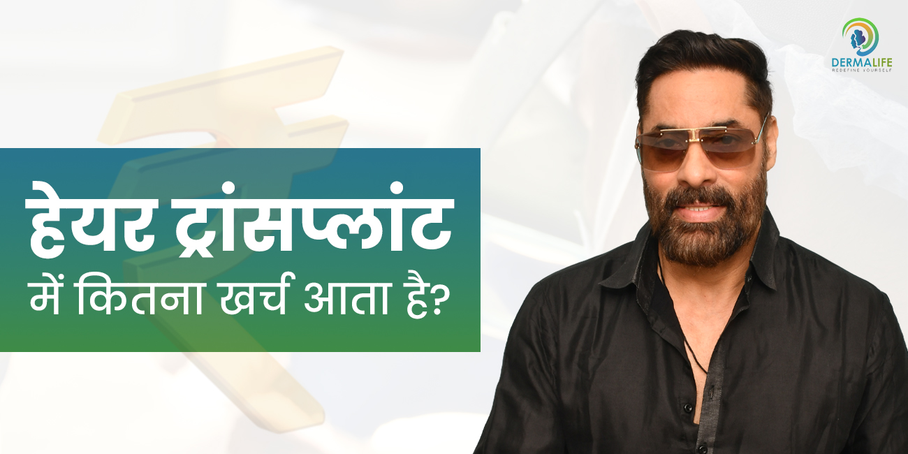 दिल्ली में हेयर ट्रांसप्लांट में कितना खर्च आता है