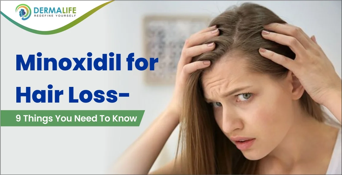 Minoxidil for hair loss- 9 things you need to know