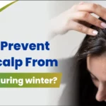 How to Prevent Your Scalp From Dandruff during winter?