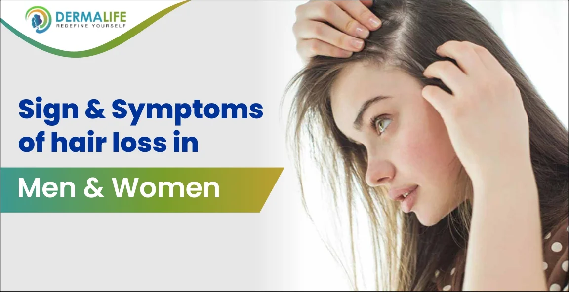 sign & symptoms of hair loss in men & women