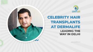 Celebrity Hair Transplants Dermalife Leading the Way in Delhi