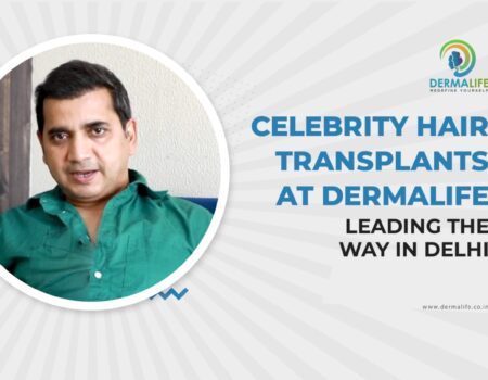 Celebrity Hair Transplants Dermalife Leading the Way in Delhi