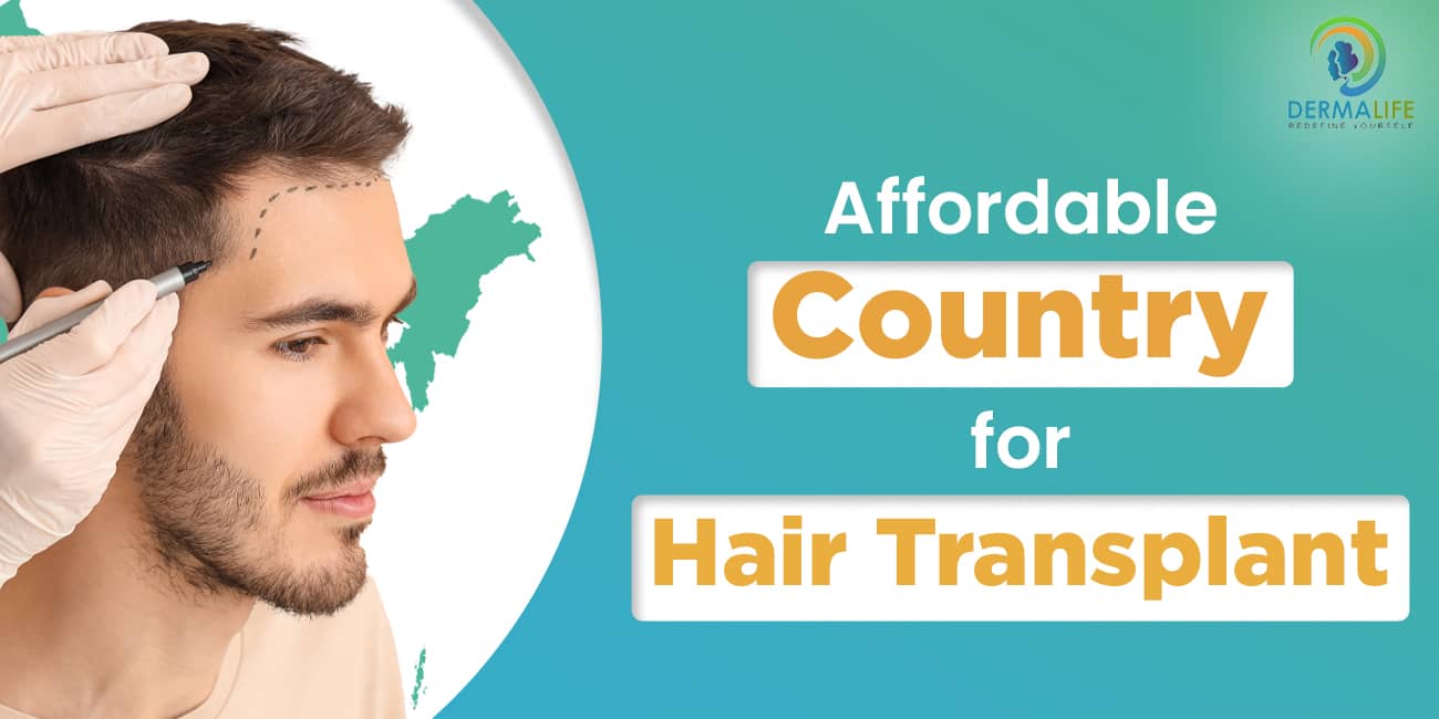 Hair Transplant Surgery in India A Reliable and Affordable Country for Hair Transplant Surgery