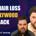 Bakhtiyar Irani's Hair Transplant Journey From Hair Loss to Bollywood Comeback
