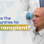 What are the best countries for hair transplant