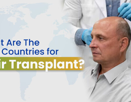 What are the best countries for hair transplant