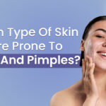 Which Type of Skin is More Prone to Acne and Pimples
