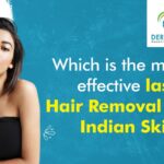 Which is the Most Effective Laser Hair Removal for Indian Skin