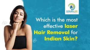 Which is the Most Effective Laser Hair Removal for Indian Skin