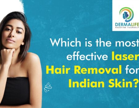 Which is the Most Effective Laser Hair Removal for Indian Skin