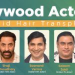Bollywood actors who did hair transplant