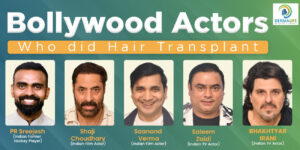 Bollywood actors who did hair transplant