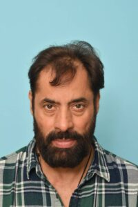 Shaji Chaudhary Before Hair Transplant Image