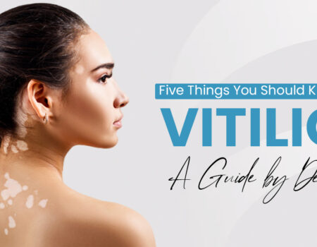 Five Things You Should Know About Vitiligo A Guide by Dermalife