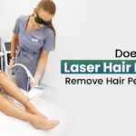 Does Laser Hair Removal Remove Hair Permanently?