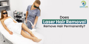 Does Laser Hair Removal Remove Hair Permanently?
