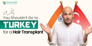 Why You Should not go to Turkey for a Hair Transplant