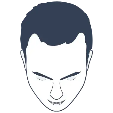 Hair Loss Type 1