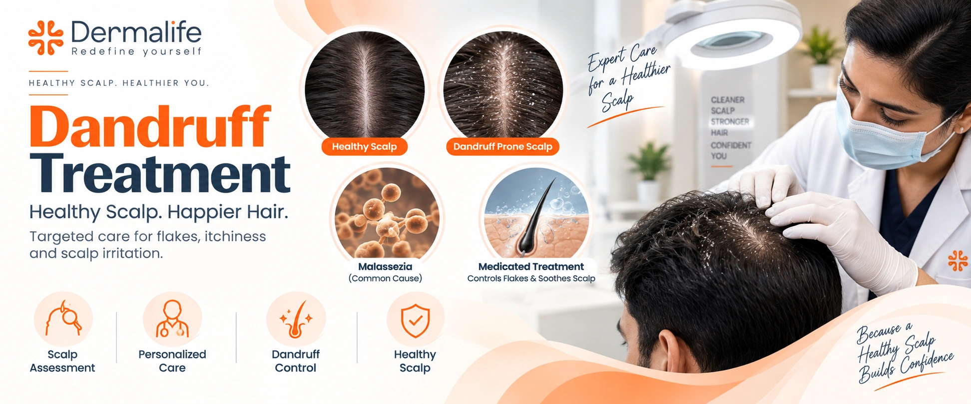 Best Dandruff Treatment in Delhi is available at Dermalife