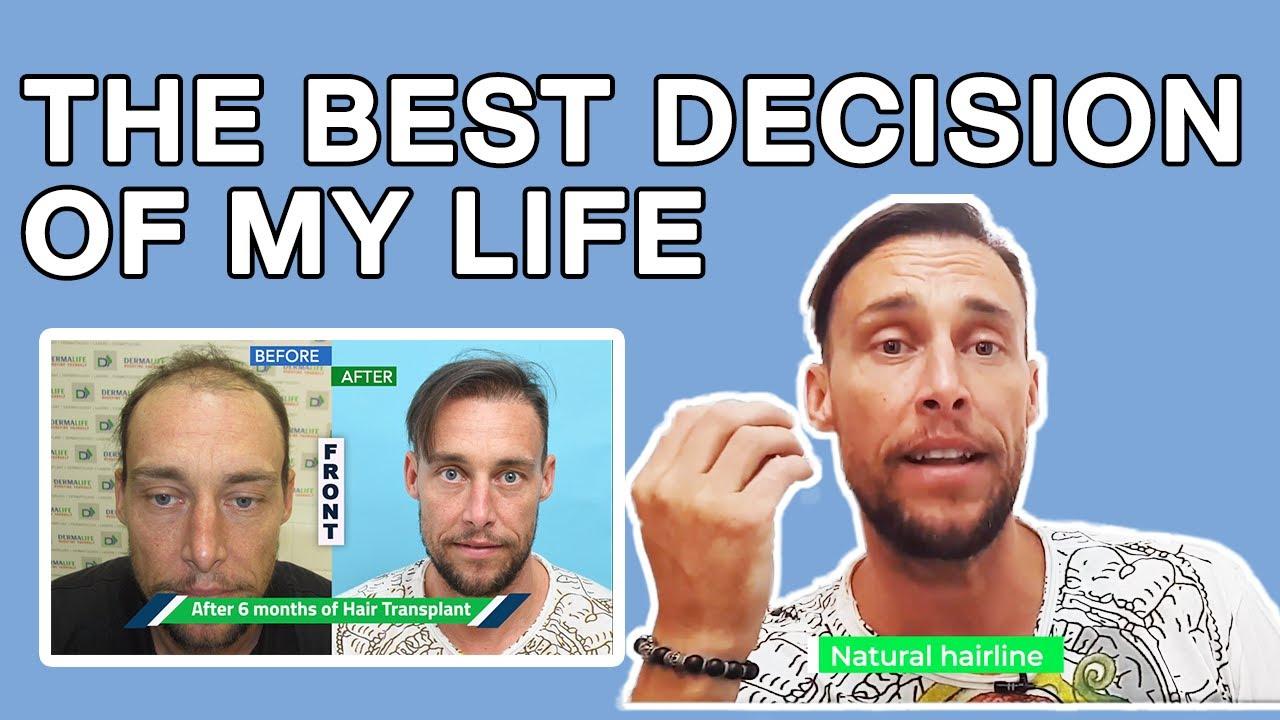 Dermalife - Best Skin and Hair Clinic in Delhi